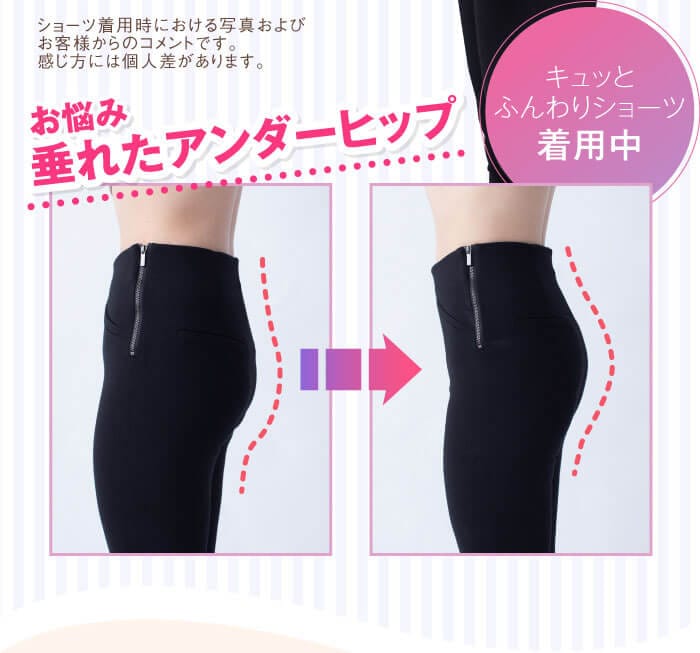 お悩み・垂れたアンダーヒップ　ショーツ着用時における写真およびお客様からのコメントです。感じ方には個人差があります。