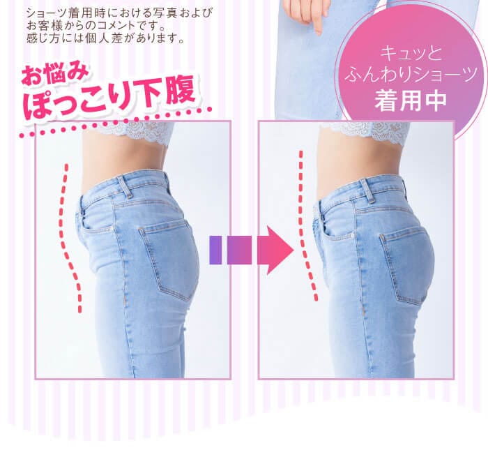 お悩み・ぽっこり下腹　ショーツ着用時における写真およびお客様からのコメントです。感じ方には個人差があります。